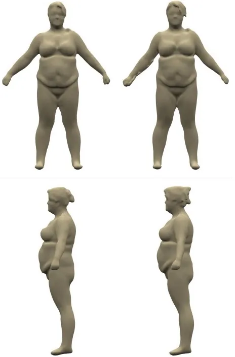 Before and after weight loss results