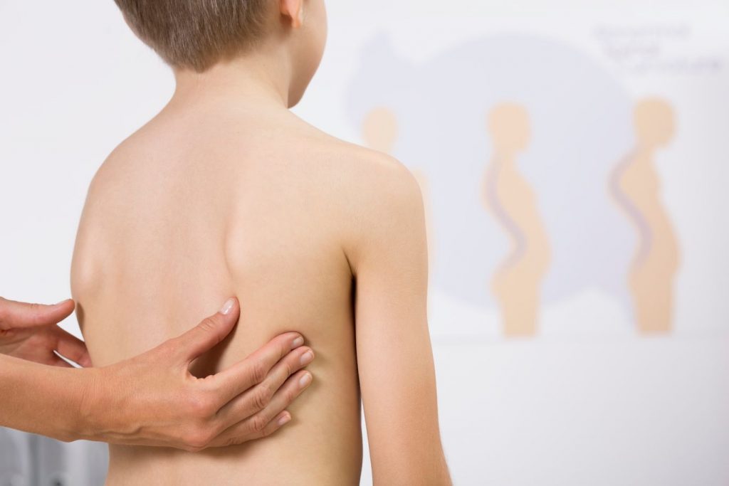 Child with scoliosis