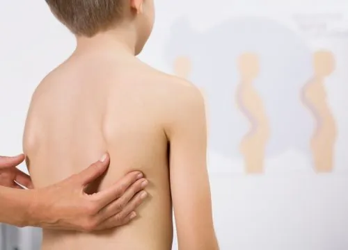 Child with scoliosis