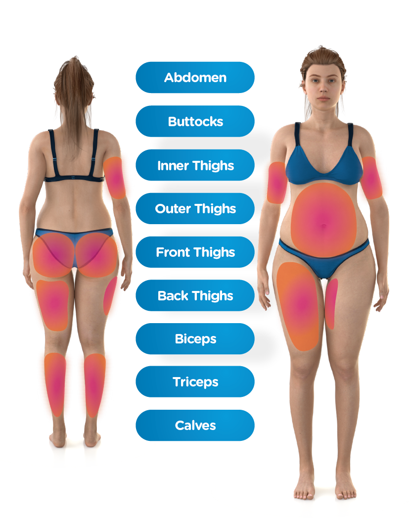 Areas of the body that Emsculpt NEO treats